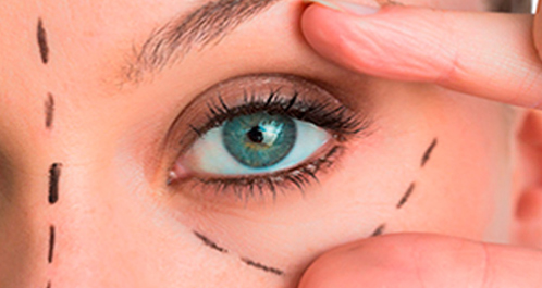 laserdeplasma